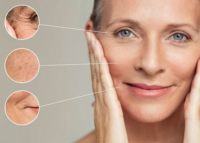 پرسش و پاسخ های متداول درباره هایفوتراپی و آر اف