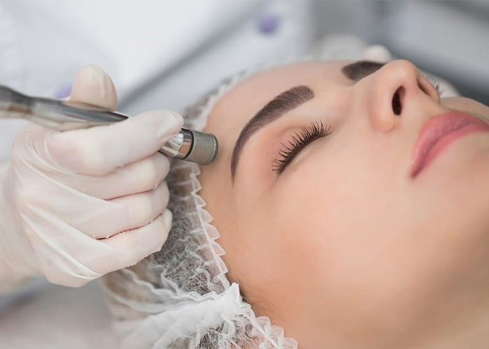 Read more about the article اثر میکرودرم ابریژن بر روی منافذ پوست