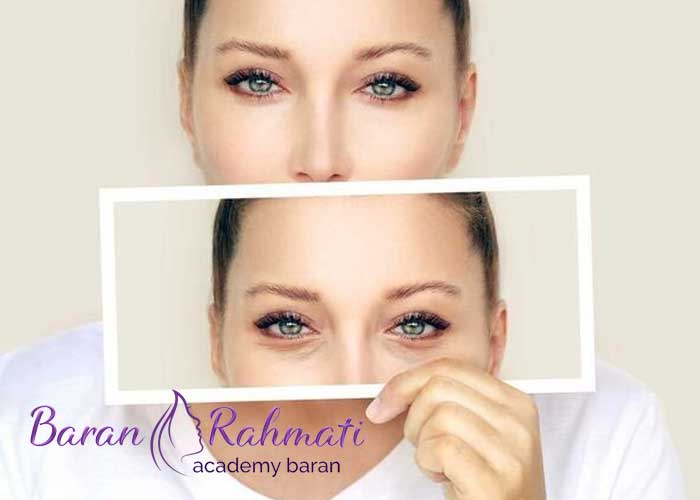 Read more about the article آموزش بلفاروپلاستی در اصفهان