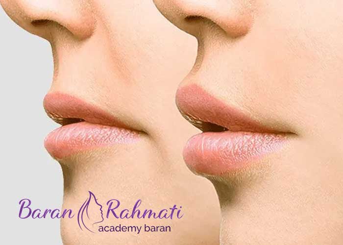 هزینه دوره ‌های آموزش سانترال لب در مشهد