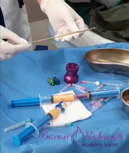 سرفصل‌ های دوره آموزش تزریق چربی در مشهد