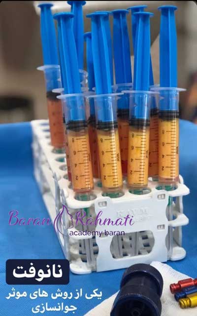 مزایای تزریق چربی