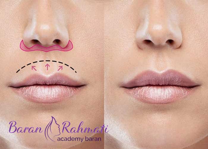 Read more about the article آموزش سانترال لب در اصفهان