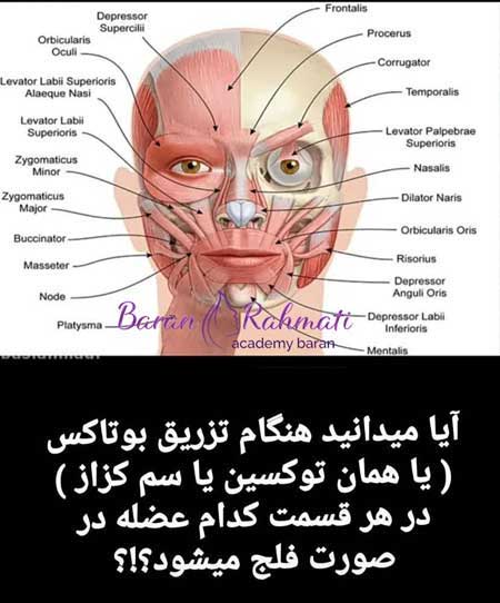 بهترین مرکز آموزش تزریق ژل و بوتاکس در اهواز کجاست؟