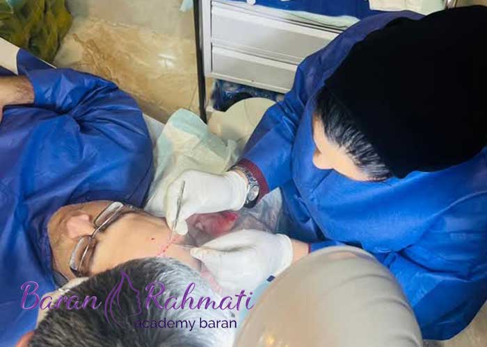 Read more about the article آموزش کاشت مو در مشهد