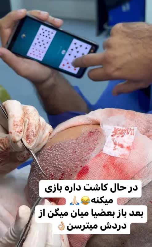 دوره ی آموزش کاشت مو در شیراز
