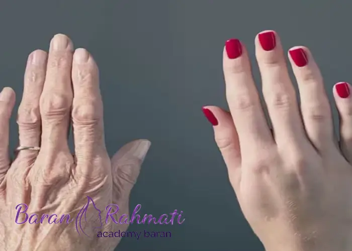 تزریق چربی در اصفهان