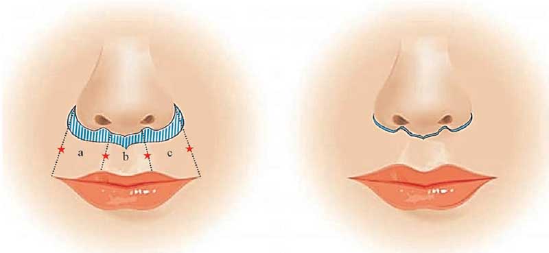 آموزش سانترال لب در یزد
