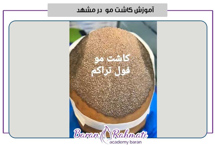 آموزش کاشت مو در مشهد