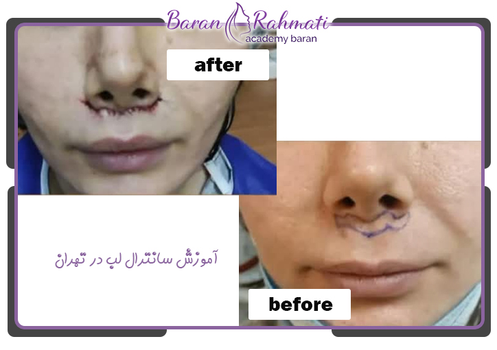 آموزش سانترال لب در تهران