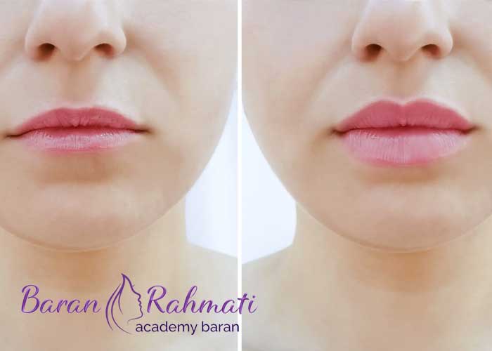 Read more about the article آموزش سانترال لب در تهران