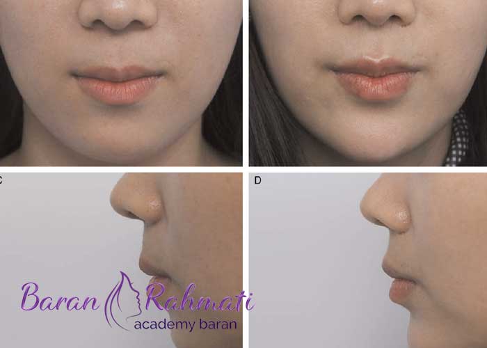 Read more about the article آموزش سانترال لب در شیراز