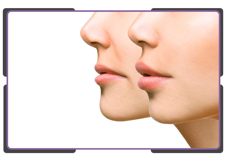 سانترال لب در تهران