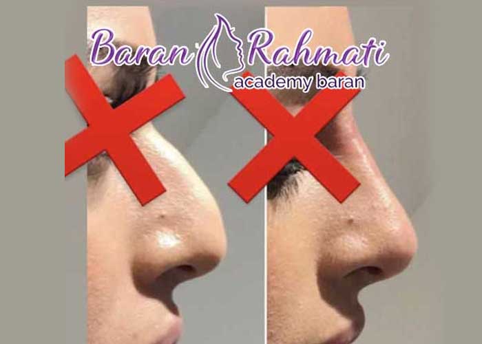 Read more about the article آموزش کوچک کردن بینی برای پزشکان به همراه روش های خانگی