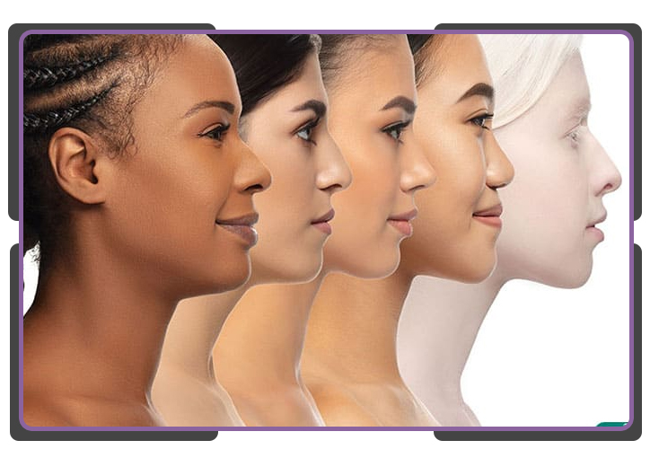 اتواع مدل بینی