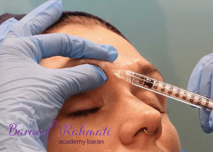Read more about the article بررسی کامل تزریق بوتاکس خط اخم (گلابا)