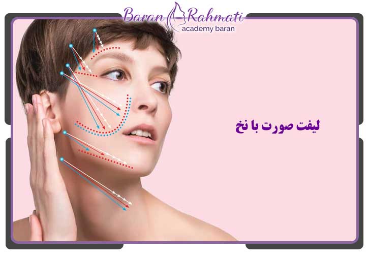 لیفت صورت با نخ