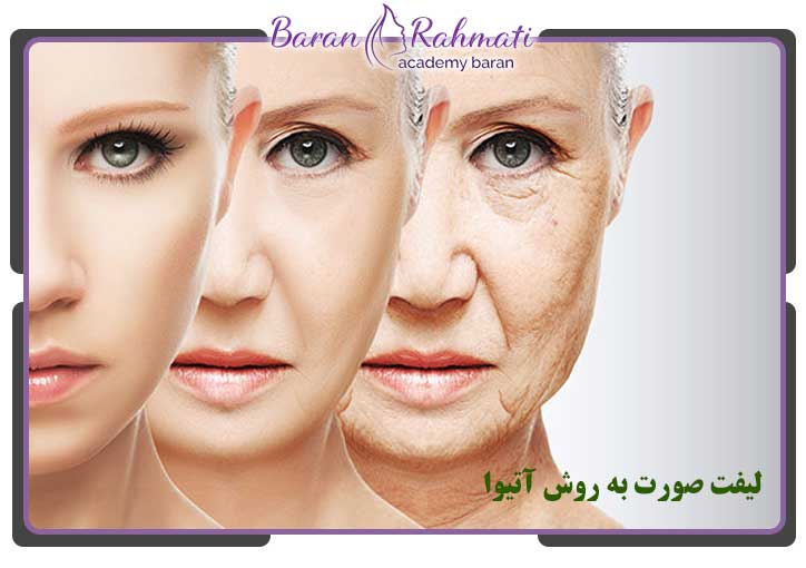 لیفت صورت به روش آتیوا