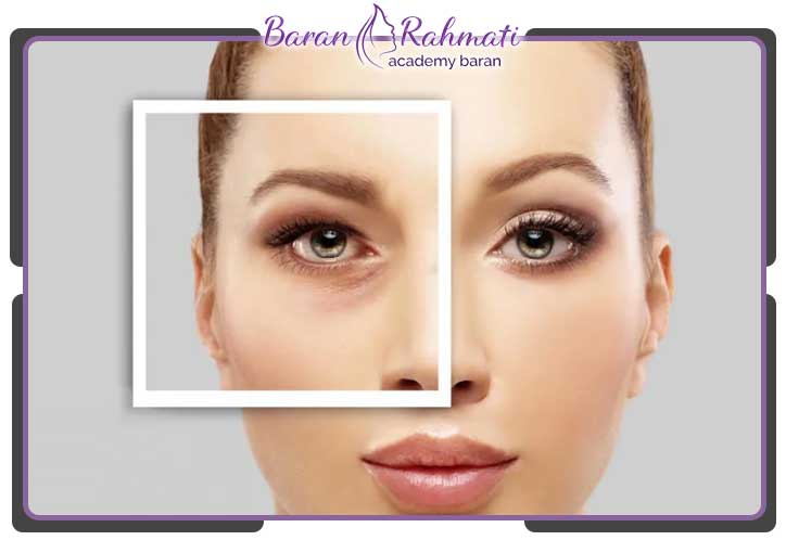 دوره های مربوط به آموزش بلفاروپلاستی رشت