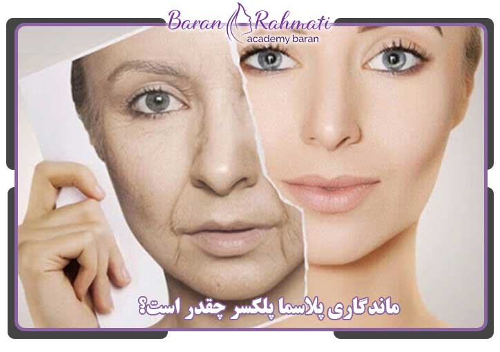 ماندگاری پلاسما پلکسر چقدر است؟