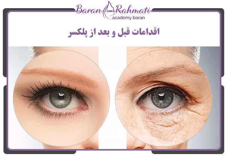 عکس قبل و بعد پلکسر پلک