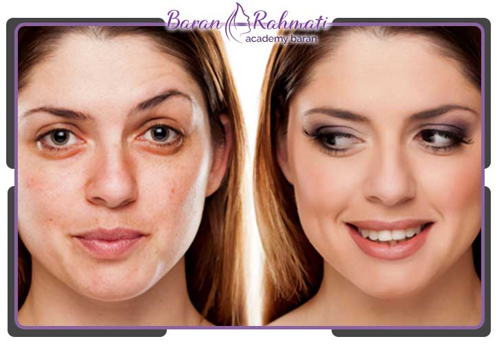 چه کسانی برای زاویه سازی فک مناسب هستند؟