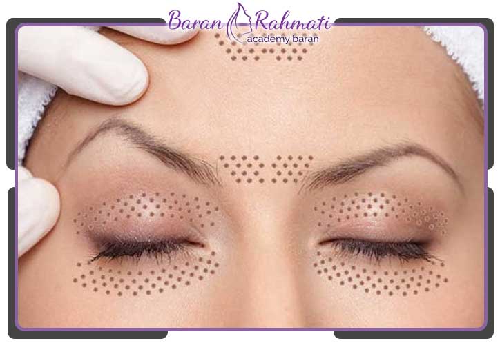 کاربردهای پلاسما پلکسر