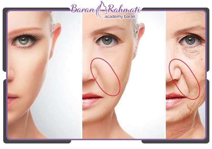 آموزش بوتاکس خط خنده