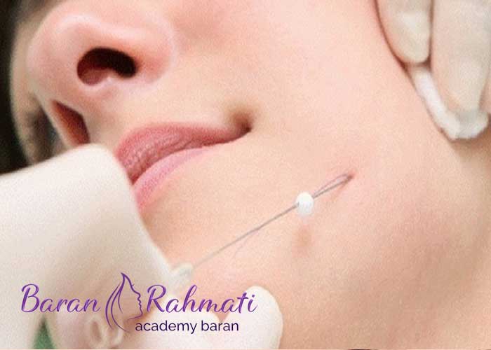 Read more about the article آموزش کاشت نخ در کرج