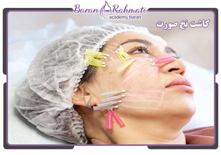  کاشت نخ در کرج