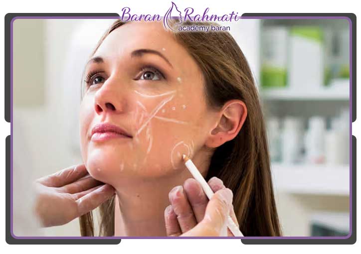 نقاط تزریق ژل برای صورت‌ های لاغر