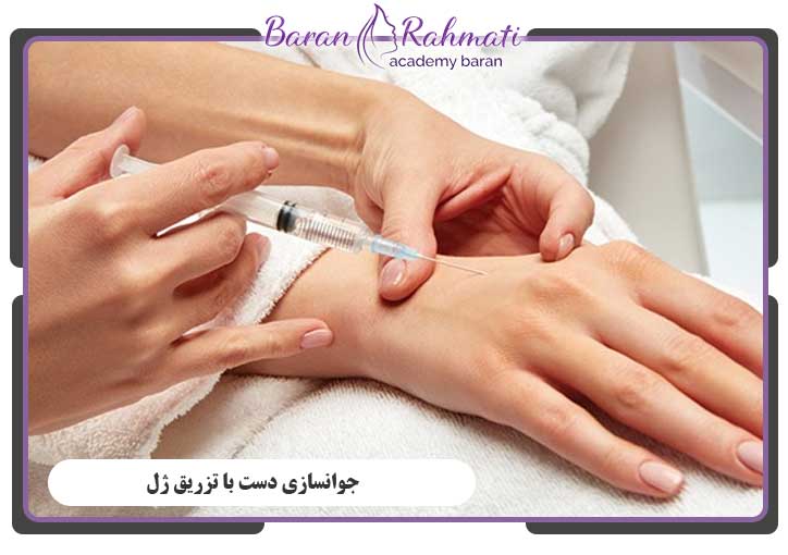جوانسازی دست با تزریق ژل