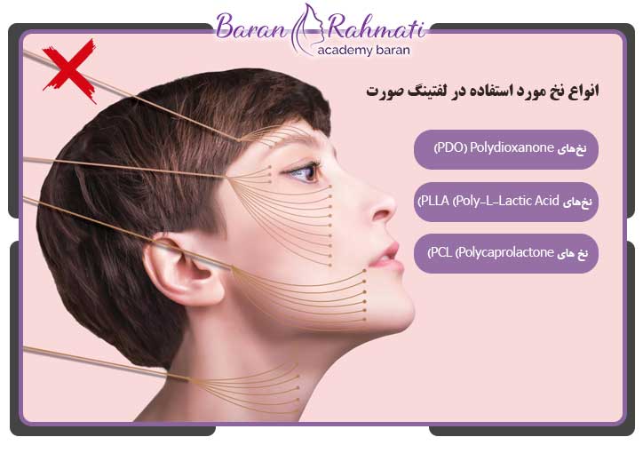 انواع نخ برای لیفت صورت با نخ