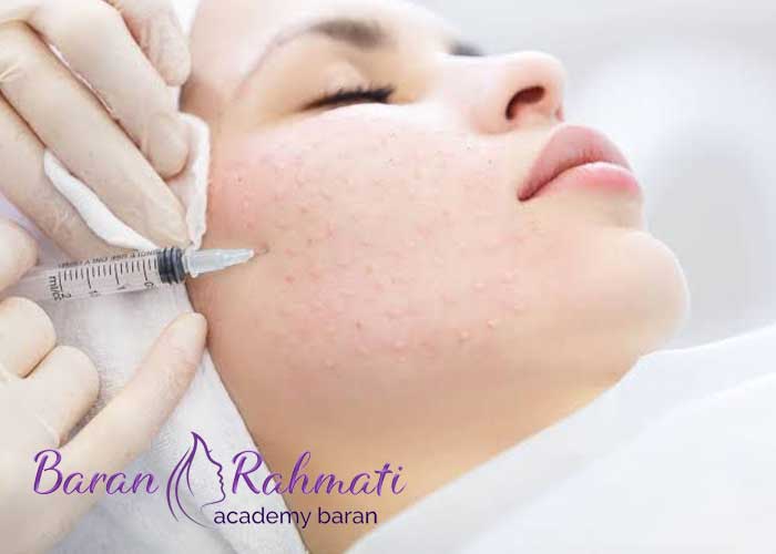 Read more about the article تزریق ژل برای چه کسانی ممنوع است؟