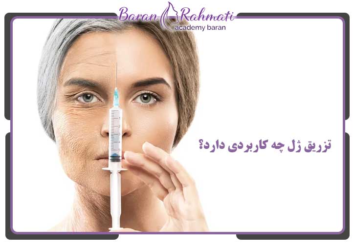 تزریق ژل چه کاربردی دارد؟