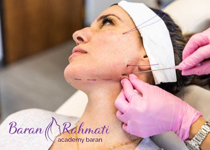 Read more about the article آموزش کاشت نخ اهواز