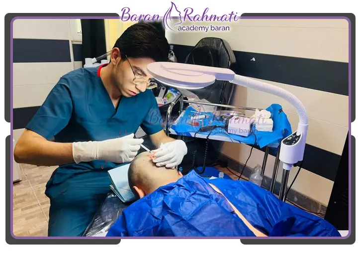 بهترین آموزشگاه کاشت مو در قم