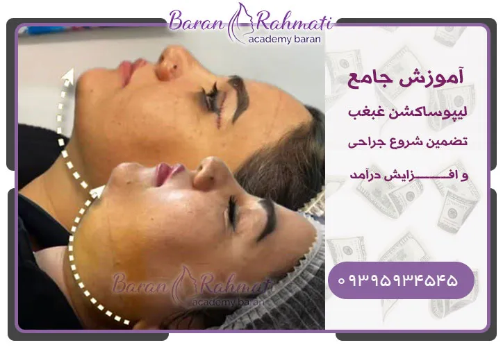 بهترین آموشگاه رفه غبغب در شیراز