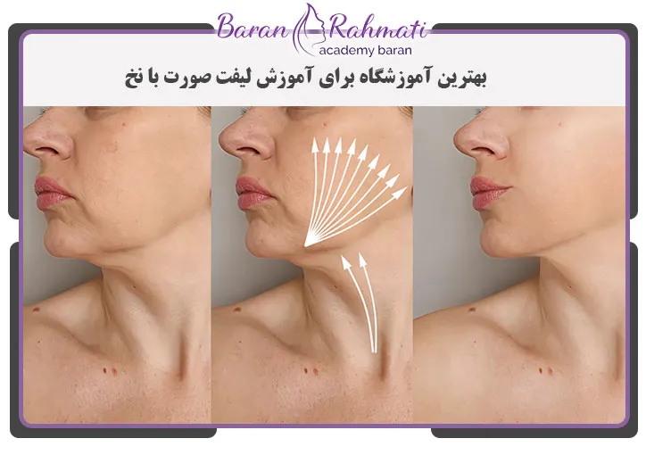 بهترین آموزشگاه برای آموزش لیفت صورت با نخ در رشت