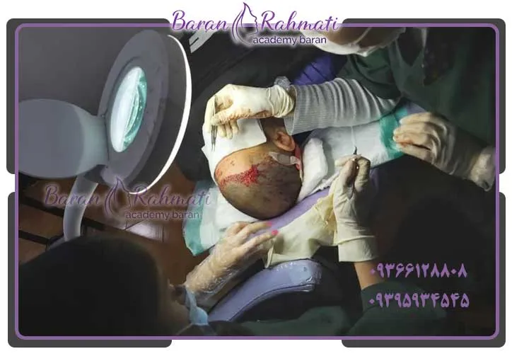 بهترین آموزشگاه کاشت مو در کرج