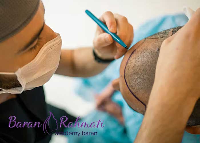 You are currently viewing آموزش کاشت مو در ارومیه