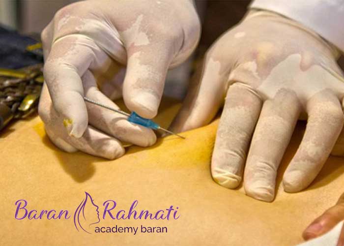 Read more about the article آموزش کاشت نخ لاغری در کرمانشاه (آموزش کاشت نخ امبدینگ در کرمانشاه)