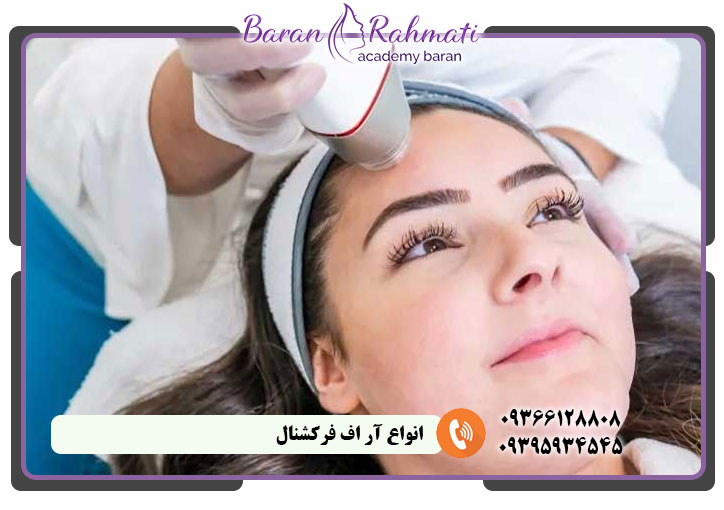 انواع آر اف فرکشنال