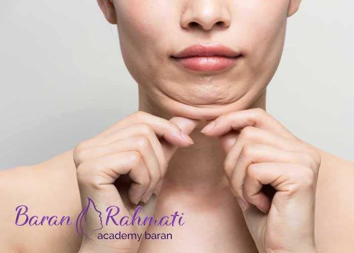 Read more about the article آموزش لیپوساکشن غبغب در تبریز