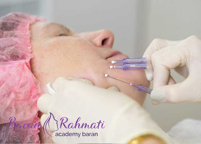 Read more about the article آموزش کاشت نخ لیفت در تبریز