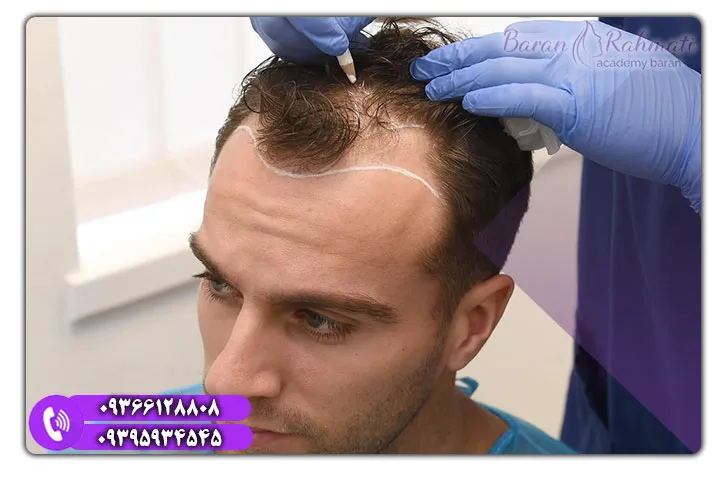 آموزش عملی کاشت ابرو برای مبتدیان در کیش