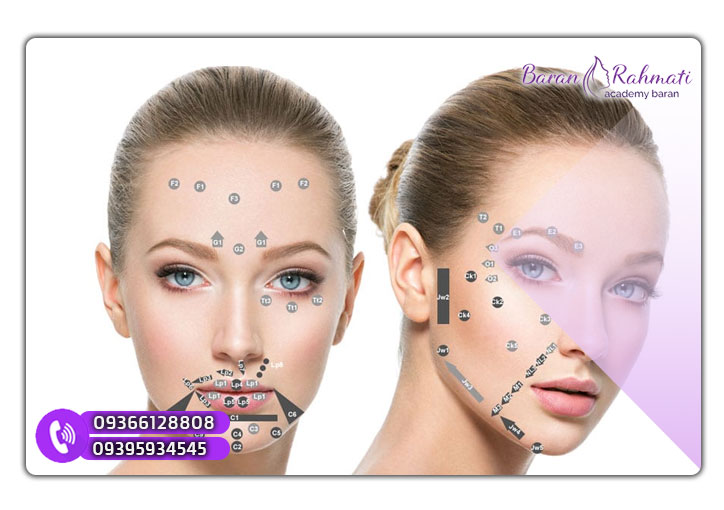 مراقبت ‌های بعد از تزریق فیلر با تکنیک MD Codes