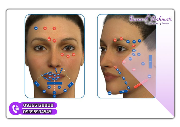 مزایای تزریق فیلر با تکنیک MD Codes