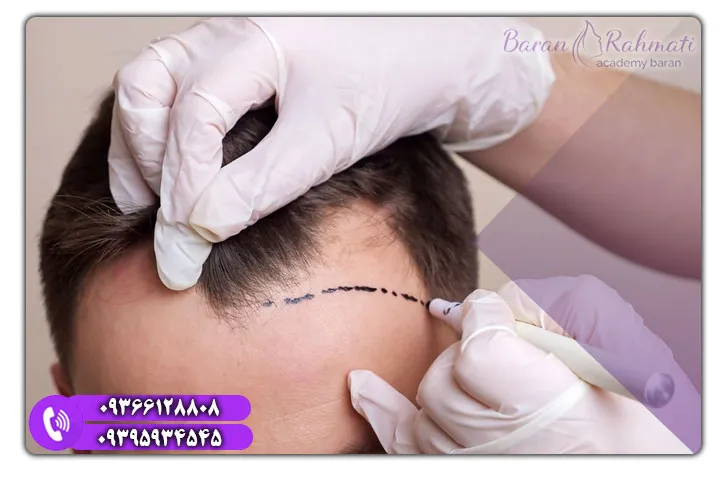 هزینه و شرایط دوره‌های آموزش کاشت ابرو در کیش