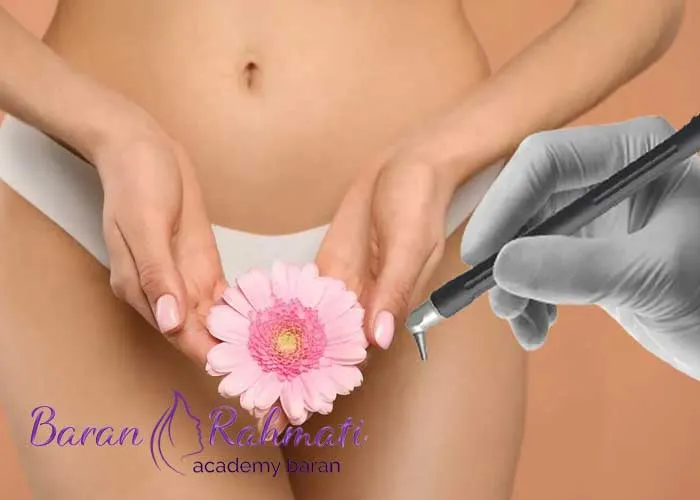 Read more about the article آموزش لابیاپلاستی در رشت